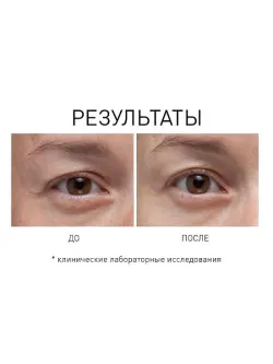 Opti Crystal Liquid Crystal Eye Serum – Сыворотка для кожи вокруг глаз с жидкими пептидами