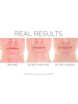 C.P.R. Skin Recovery Serum – Антикуперозная сыворотка