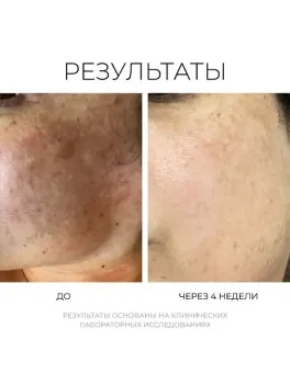 REVERT Boosting Brightening Serum – Осветляющая корректирующая сыворотка