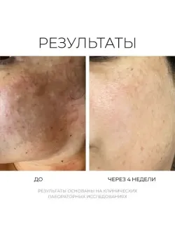 REVERT Boosting Brightening Serum – Осветляющая корректирующая сыворотка